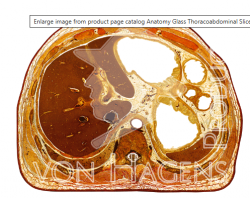 Anatomy Glass