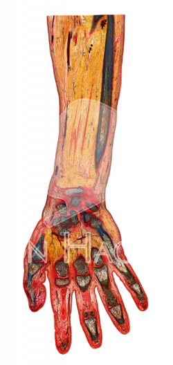 Sheet Plastinates